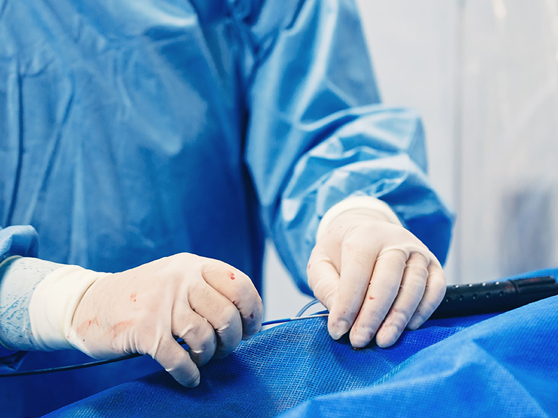 Ενδοαγγειακές Τεχνικές